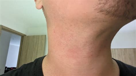 How to prevent razor burn for a consistently sharp, irritation-free look?