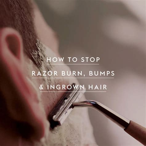 Prevent razor burn & ingrowns effectively?