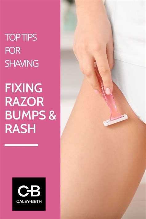 Fixing razor bumps and rash top tips for shaving – Artofit