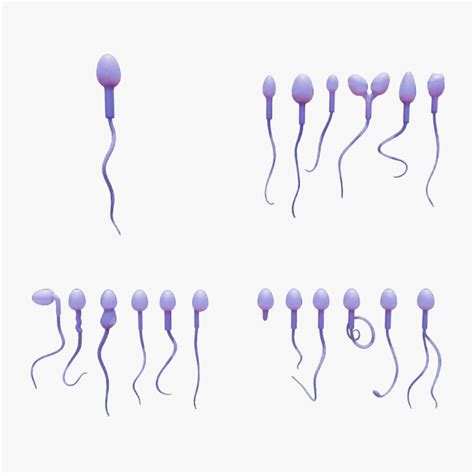 3D file Sperm Morphology: Normal and Abnormal・3D printing model to download・Cults