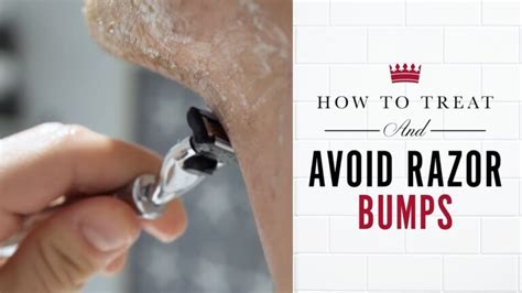 Prevent razor bumps/ingrowns: best shave prep?