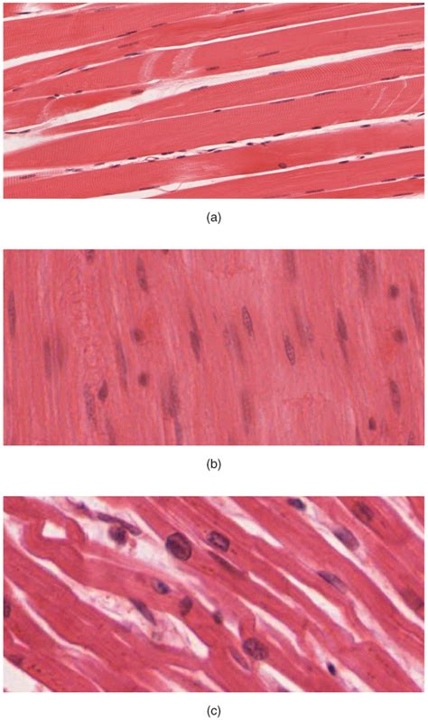 Types of Muscle Tissue | Physiology | Geeky Medics