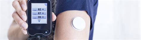 10 Ways Wearable Technology Transforms the Healthcare - techovedas