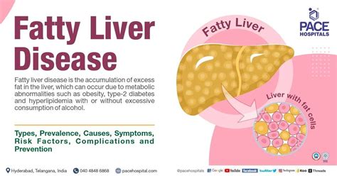 Fatty Liver Symptoms, Grade, Causes, Complications, Prevention | by ...