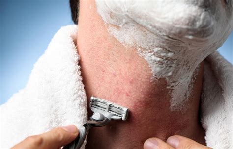 12 Home Remedies For Razor Bumps on Neck