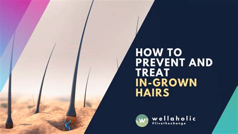 How to Prevent and Treat Ingrown Hairs