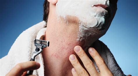 How to Get Rid of Razor Burn for Good - Men’s Shaving Tips