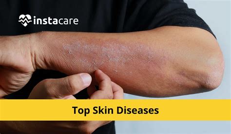 Skin Disease Database at Douglas Nunez blog