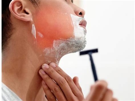 Razor Burn: What Is It? - The Laser Studio