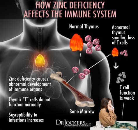 15 Zinc Deficiency Symptoms and Best Food Sources - DrJockers.com