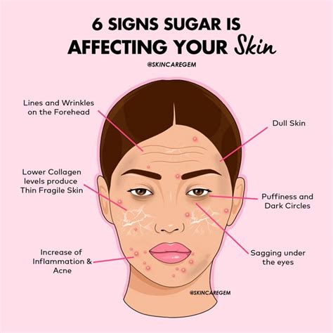 Your skin reflects your internal health! | Skin care, Healthy skin tips, Skin care routine