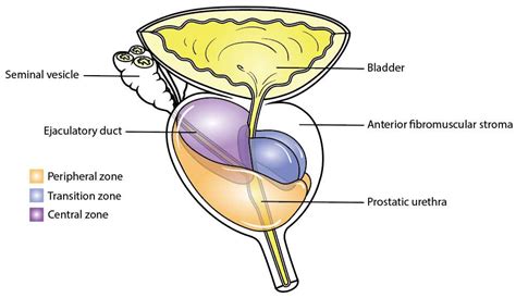 Molecular Anatomy of Prostate Cancer and Its Implications in Active Surveillance and Early ...