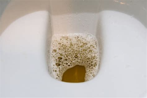129 Urine Healthy Toilet Bowl Stock Photos - Free &amp; Royalty-Free Stock Photos from Dreamstime