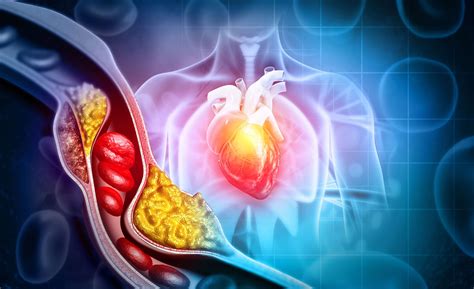 Managing Cholesterol: A Comprehensive Guide