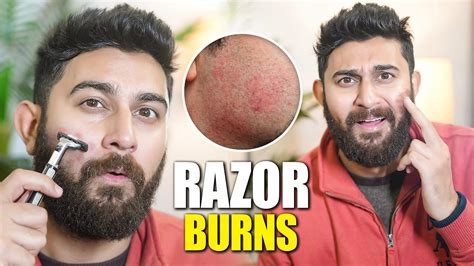 How to prevent razor burn when shaving?