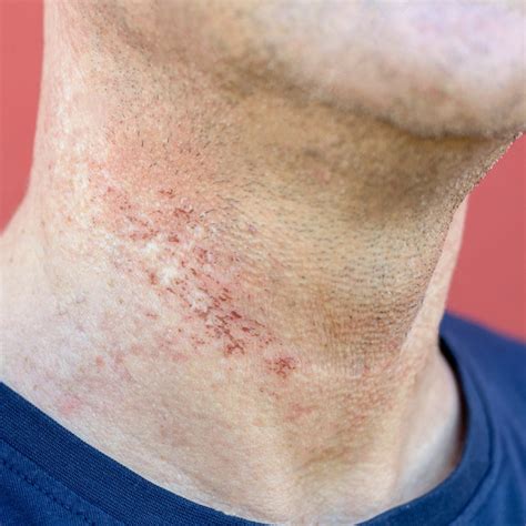 Common Concerns - MD Aesthetica