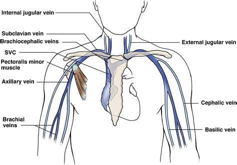 Upper Extremity Venous Doppler Ultrasound - Radiologic Clinics