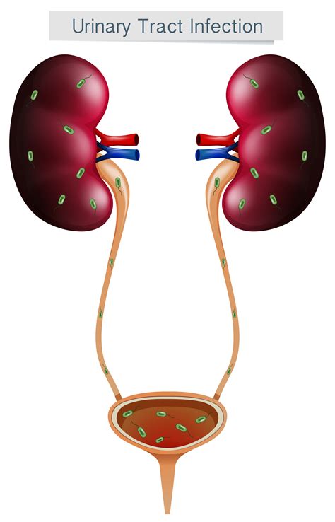 Urinary Tract