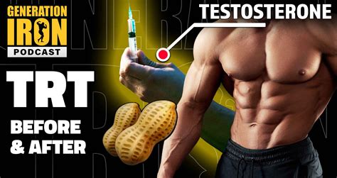 Before & After Using TRT: Pros & Cons Of Testosterone Replacement ...