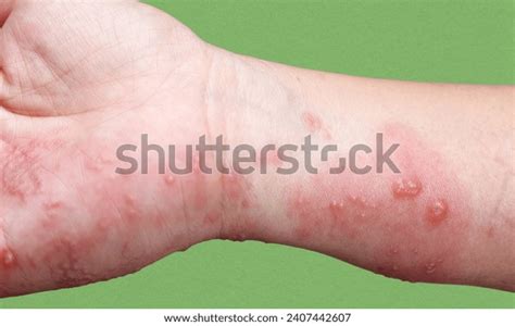 Gordelroos: stockfoto‘s en -afbeeldingen - 136.856 afbeeldingen | Shutterstock