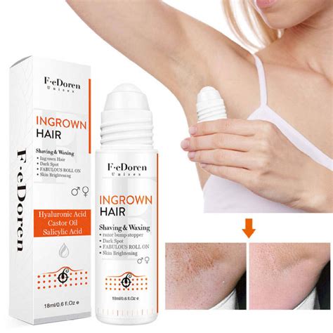 Preventing razor burn. 6 Dermatologist-Approved Tips to Prevent Razor ...