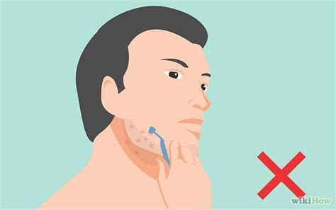 How to prevent razor burn and ingrowns for a high-performance, irritation-free shave?