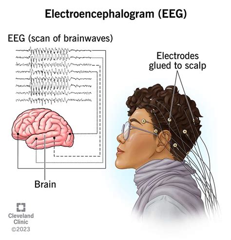 Electroencephalogram (EEG): What It Is, Procedure & Results