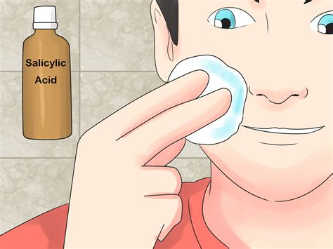 2 Easy Ways to Prevent Ingrown Hairs (with Pictures)