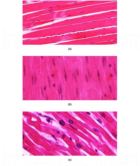 Muscle Tissue