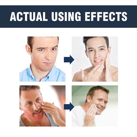 Prevent razor burn & ingrowns: achieve a smooth, professional shave?