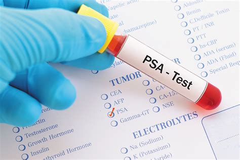Should I continue to get regular PSA testing after age 70? - Harvard Health