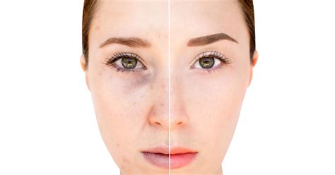 6 Examples Showing How Our Habits Affect Our Appearance / Bright Side