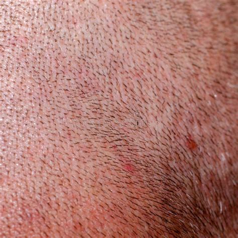 Shaved Human Skin on Head Close-up Stock Image - Image of closeup, skin ...