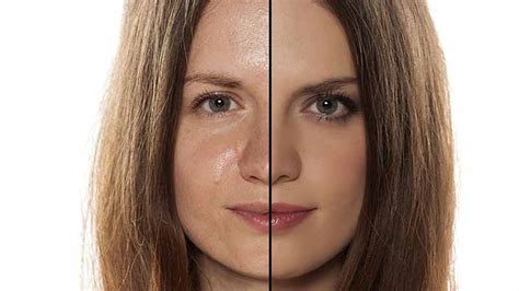 Ways To Manage Oily Skin And Prevent Skin Issues - The Wellness Corner