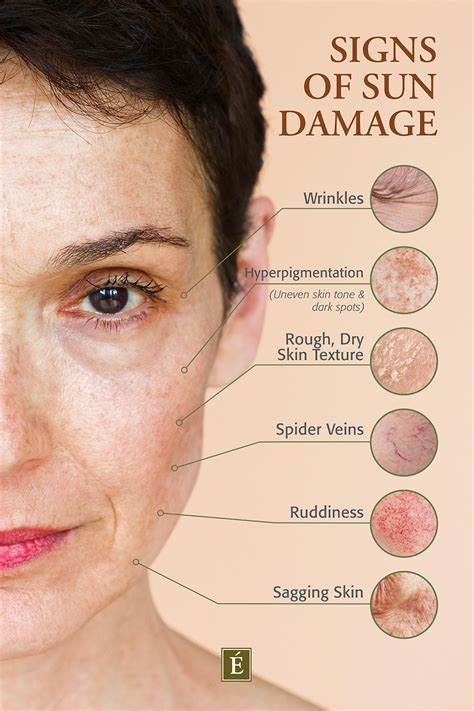 What Does Sun Damaged Skin Look Like? - Shop.abe.institute