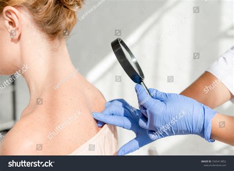 Cropped View Dermatologist Examining Skin Patient Stock Photo 1565413852 | Shutterstock