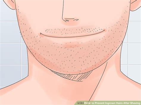 Best way to prevent ingrown hairs after shaving face?