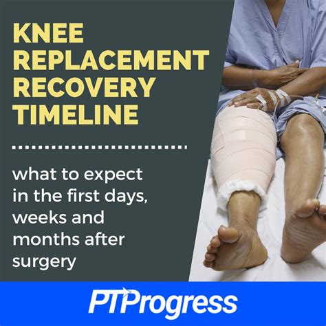Knee Replacement Recovery Timeline: What to Expect – Sports stars who live in Cabo