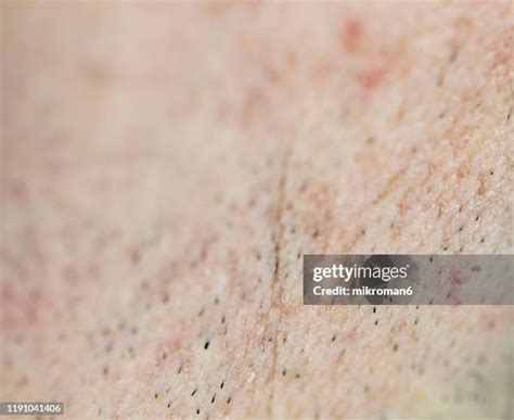 Shaved Skin Stock-Fotos und Bilder - Getty Images